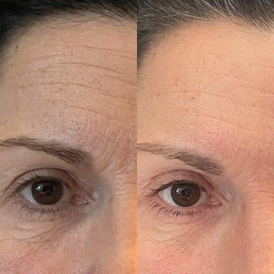 Kit ANTI AGE - Piel rejuvenecida en 45 días