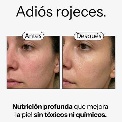 Kit para pieles sensibles y rosácea