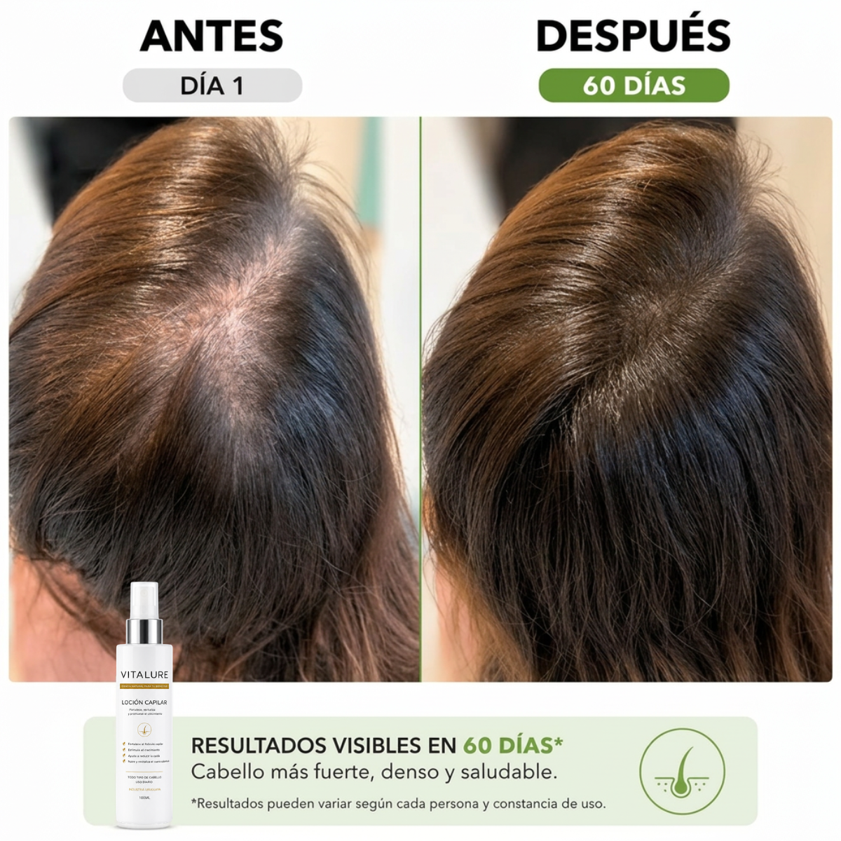 HAIR TONIC Anticaída - Recupera tu cabello en menos de 60 días